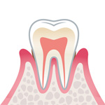 歯周病の進行と治療